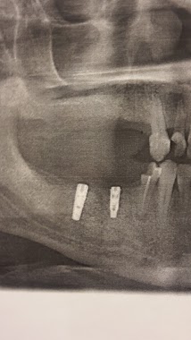 DR SAKET DUBEY ORAL SURGRON, Author: Dr Saket Dubey