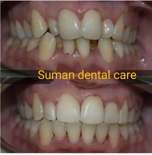 All type of orthodontic treatment post image