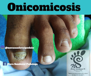 Nora Sandoval - Podología 7