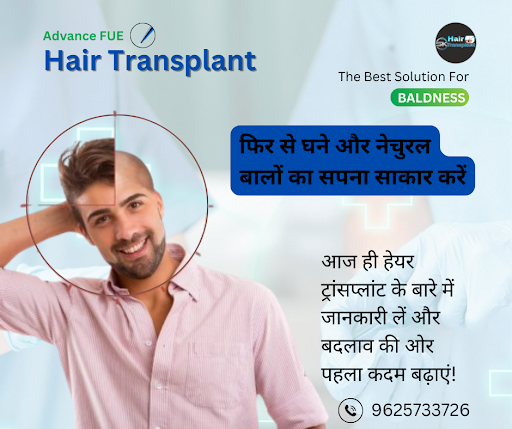 SK Hair Transplant Clinic – Noida (Sector 44) 