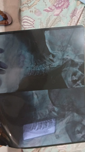 Physiotherapy clinic in Sector 37D Gurgaon post image