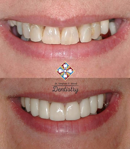 Stephen Wood DDS - Visual