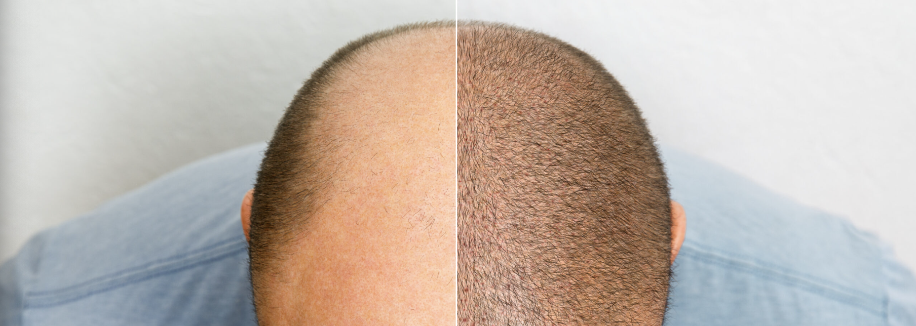 New Hair Clinic clinic 4