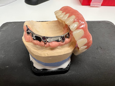 Zahnarzt & Oralchirurg-Bregenz Spezialist für Implantate & Keramikimplantate Dr. Filipowitsch, Vorklostergasse 39, 6900 Bregenz, Österreich