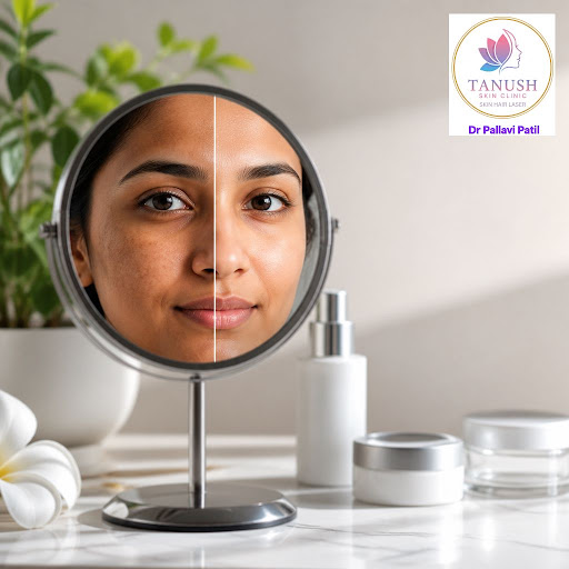 Struggling with dark spots, uneven skin tone or acne marks? At Tanush Skin & Hair Clinic in Bhiwa… post image