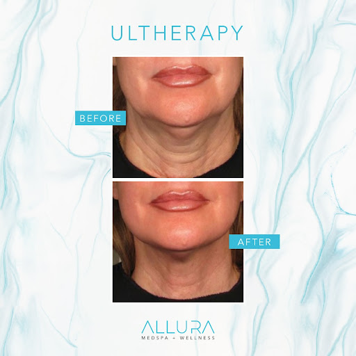 Allura Medspa + Wellness - Wellington Gallery - United States