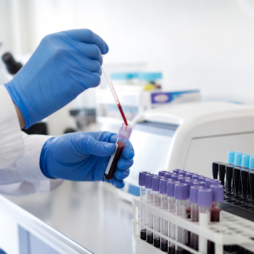 Struggling with irregular periods, weight gain, or acne and suspect PCOD? At R T Pathology Lab in… post image