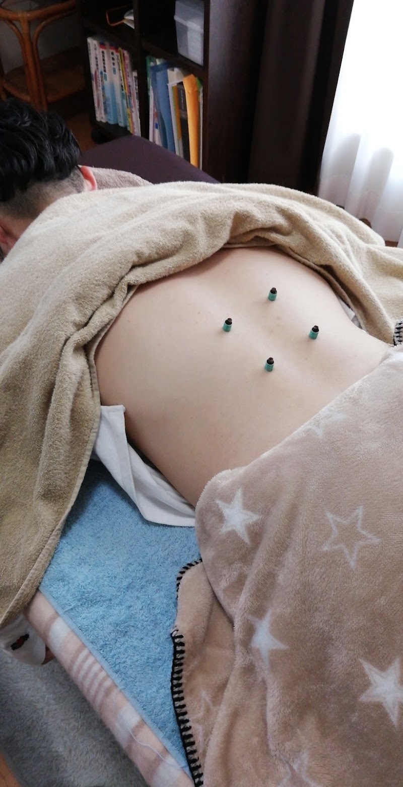 むらかみ鍼灸治療院