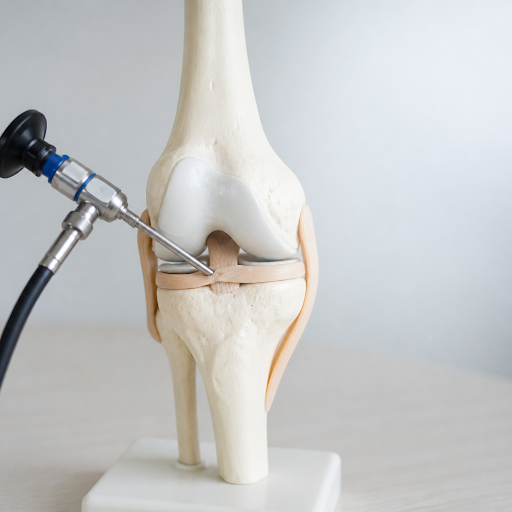 Arthroscopic surgery is a modern, minimally invasive way to treat joint problems while preserving… post image