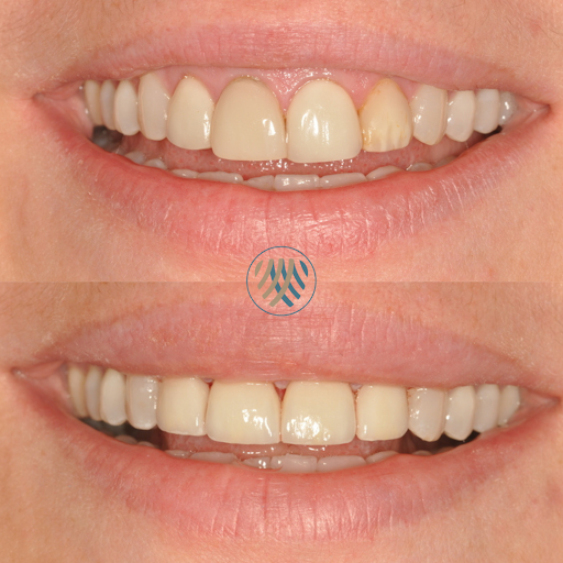 Newton Abbot Dental Gallery - United Kingdom