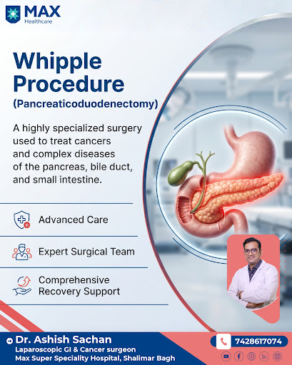 ❓When is the Whipple procedure recommended? 🩺💙 The Whipple procedure is a highly specialized surg… post image