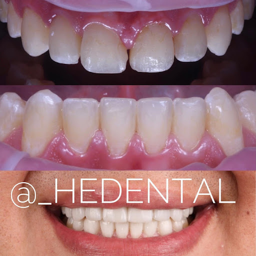 Clínica HEDental Gallery - Mexico