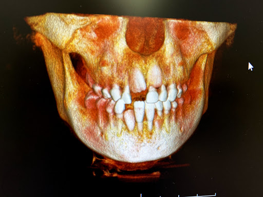 Spring Dentist - Visual