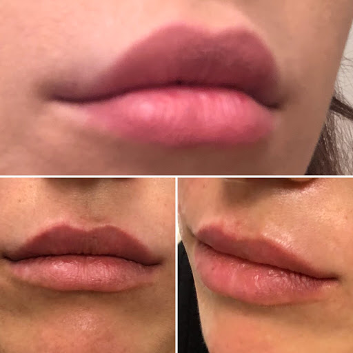 BBY Aesthetics Lip Blush Studio