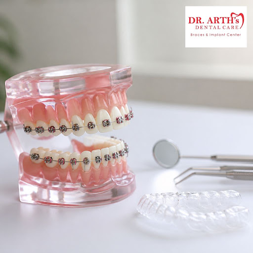 Dreaming of a confident, straight smile? At Dr Arths Dental Care Braces & Implant Center in Jodhp… post image