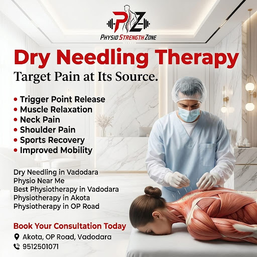 What is Dry Needling? post image