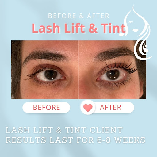 Radiant Aesthetics and Wellness - Thumbnail