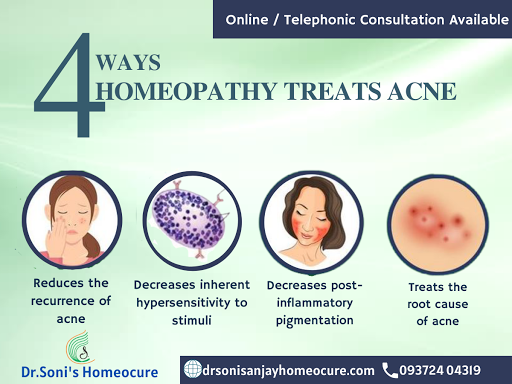 Acne is most common among teenagers, though it affects people of all ages. Effective acne treatme… post image