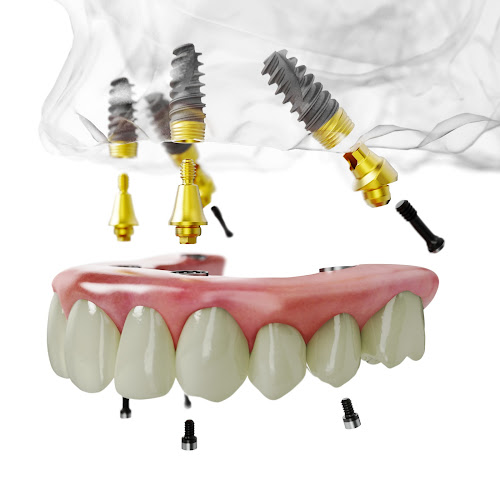 U'R Smile Dental & Aesthetic Clinic - Reading