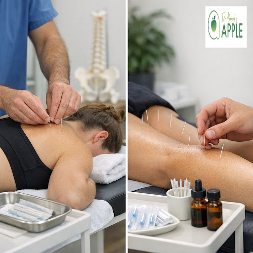 Struggling with stubborn neck, back or knee pain that just won’t go away? At Dr.Ahameds APPLE Phy…