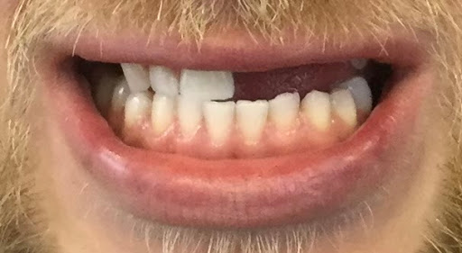 Bawtry Dental, Aesthetic & Implant Clinic | Bawtry’s # 1 Private Dental Clinic - Thumbnail
