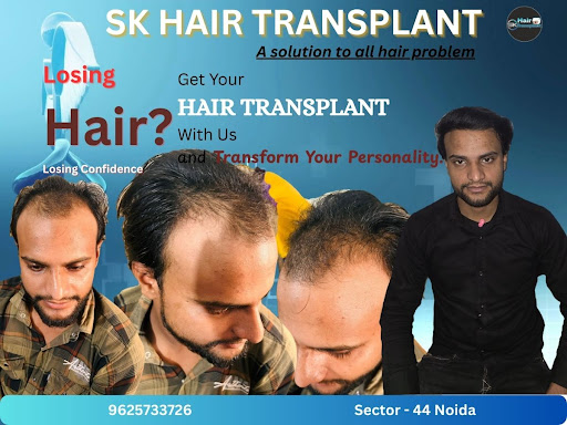 The SK Hair Transplant Clinic in Sector 44, Noida NCR, provides excellent hair loss control and i… post image