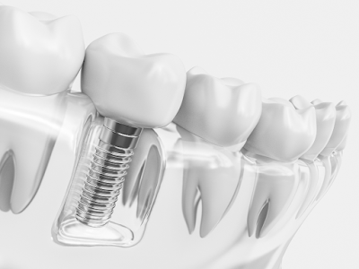 Advanced Periodontics of Lehighton