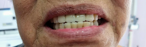 Clínica dental Cázares - Thumbnail