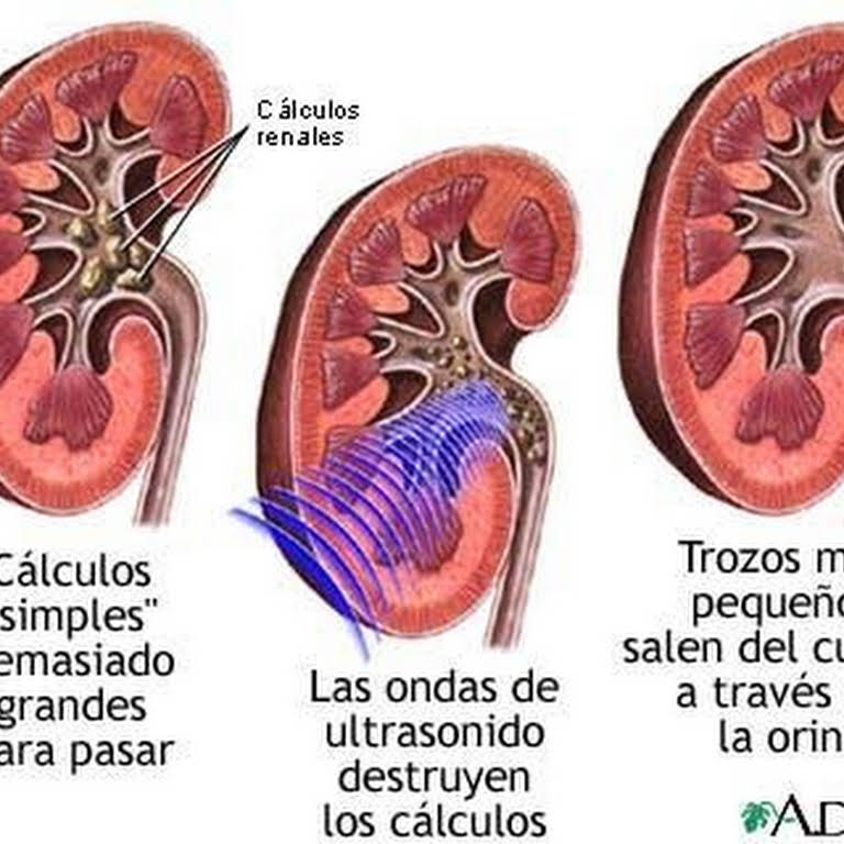 UROLOGO VICTOR NOE CERVANTES GUTIERREZ Atención médica urológica