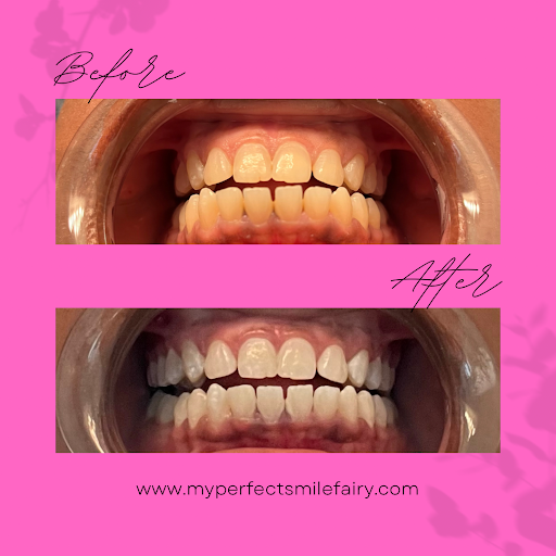 The smile fairy - Thumbnail