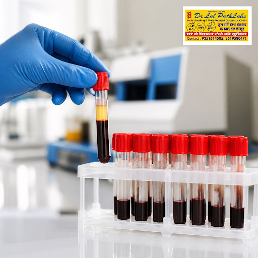 Keep your heart health on track with a detailed lipid profile test at Dr. Lal Path Labs, Imli Pha… post image