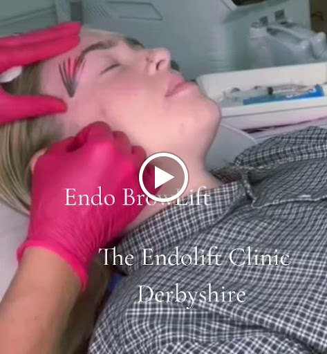 The Endo Clinic Derbyshire