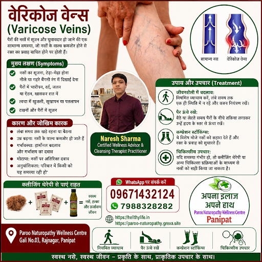 🌿 क्या पैरों की नसें सूजकर नीली या टेढ़ी-मेढ़ी दिखाई दे रही हैं? post image
