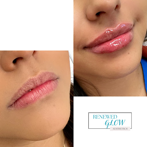 Renewed Glow Aesthetics LLC