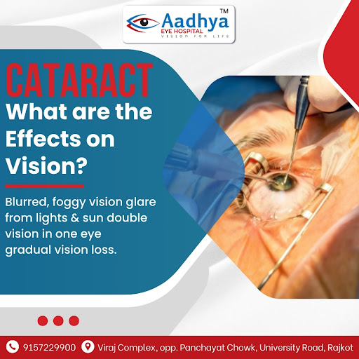 Cataracts are a common eye condition that can significantly impact vision. The effects of catarac… post image