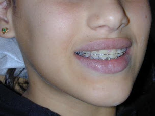 Photo n°8 de Dr. Alain Bréhat à Saint-Pierre (Orthodontiste)