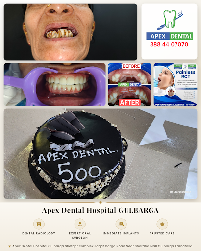 Find expert dental care at Apex Dental Hospital GULBARGA, offering Immediate Implant Dental for r… post image
