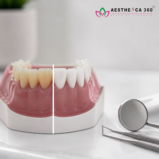 A confident smile is about much more than looks. At Aesthetica360™ - Multi-Specialty Cosmetic Cli…