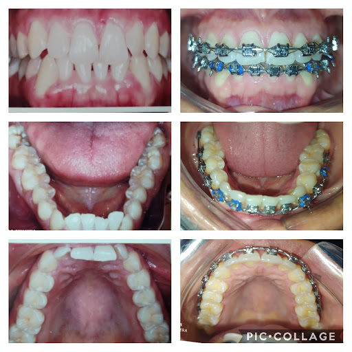 Consultorio Dental C.D. Fatima Gpe. Tinajero Perez - Thumbnail