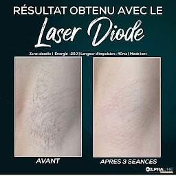 Photo n°18 de LIBERTY BEAUTÉ - Epilation laser - Corène Veron à Rosières-près-Troyes (Centre d'épilation laser)