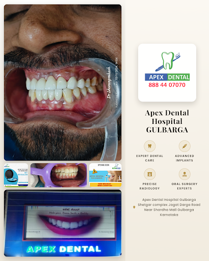 Apex Dental Hospital GULBARGA offers expert Aligners Dental treatments with advanced invisible br… post image
