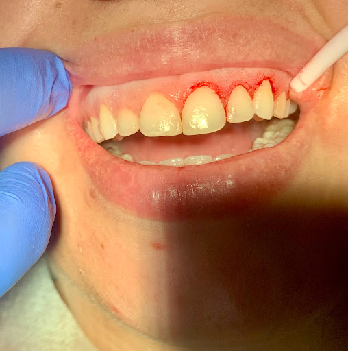 ARVI DENTAL & kids - Thumbnail