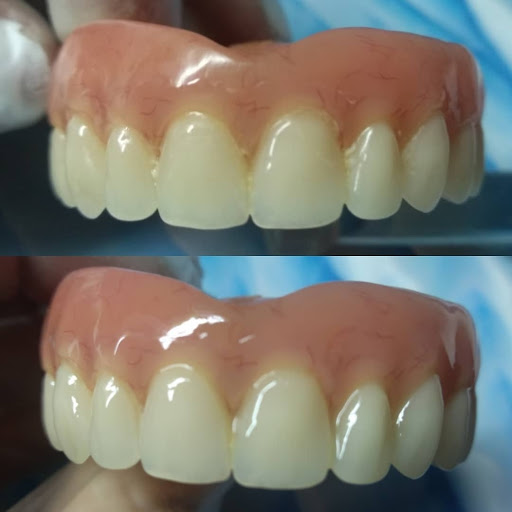 SALVADENT Centro de reparación de prótesis dentales - Thumbnail