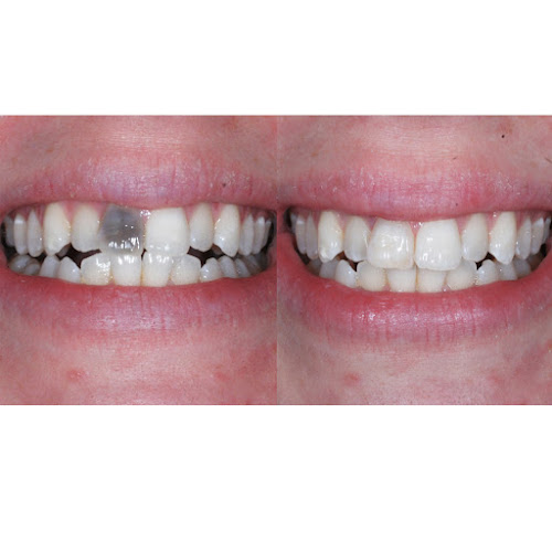 Brighton Implant Clinic (worthing branch) - Dentist