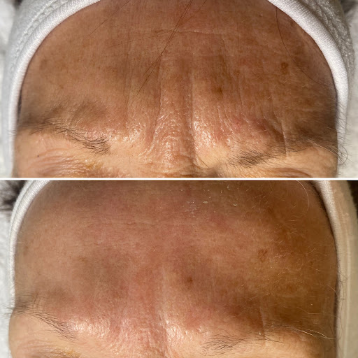 Form AVANA Massage - Thumbnail