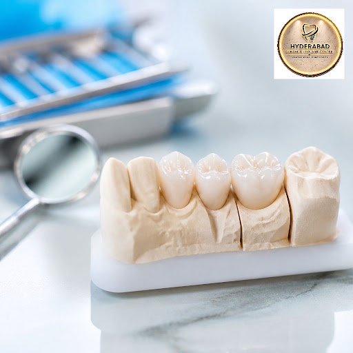 Damaged, cracked or worn teeth can affect your smile, confidence and even how you eat. At HYDERAB… post image