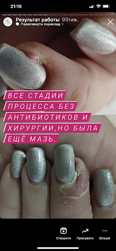 Психосоматика.