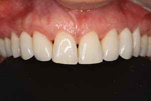 Photo n°15 de Cabinet dentaire Dr Pignoly Nicolas à Marseille (Clinique chirurgicale)