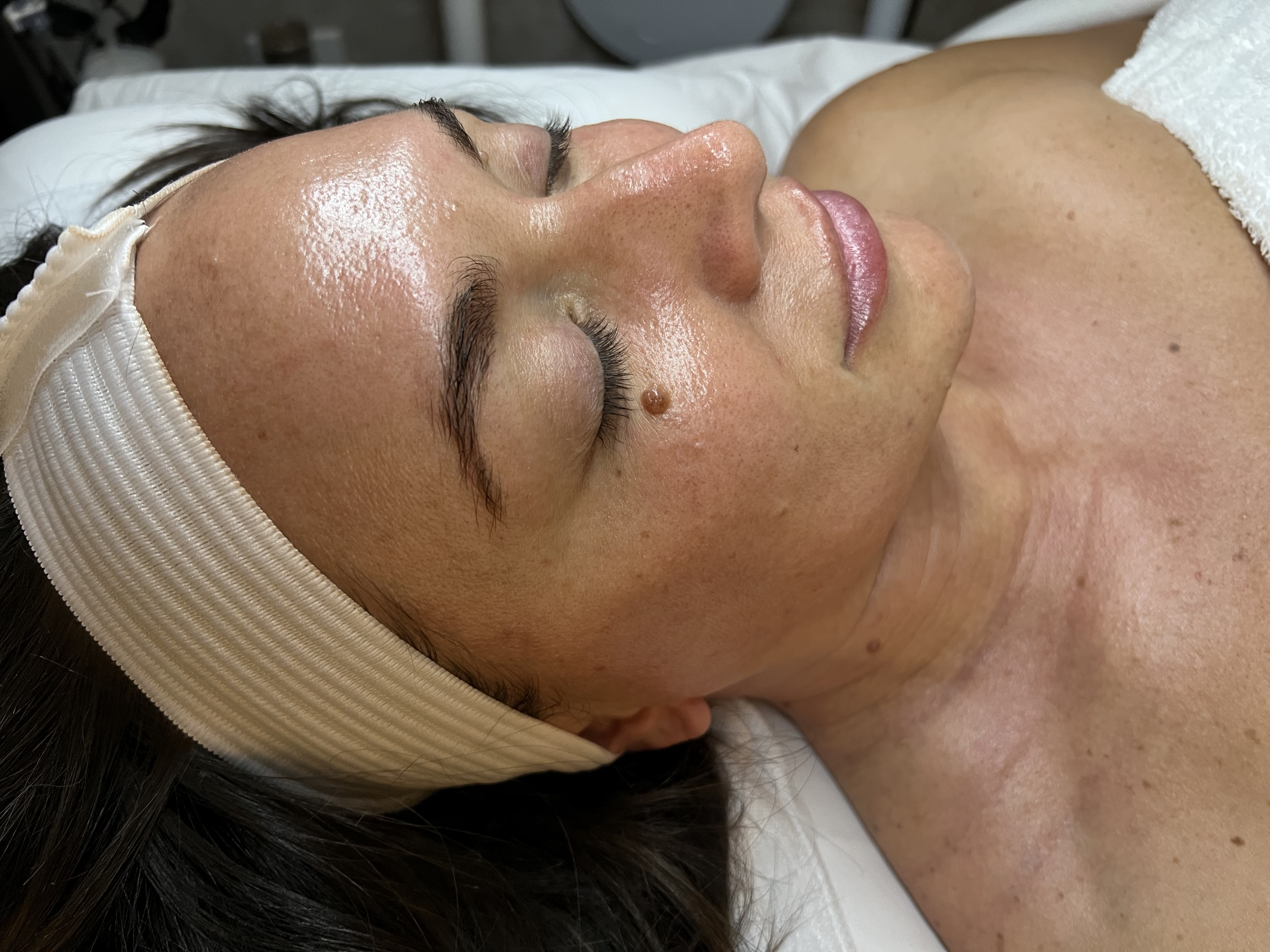 Sade Skin Co - Chemical Peels, Brows, Microneedling, Hydrafacial in Alpharetta, Georgia