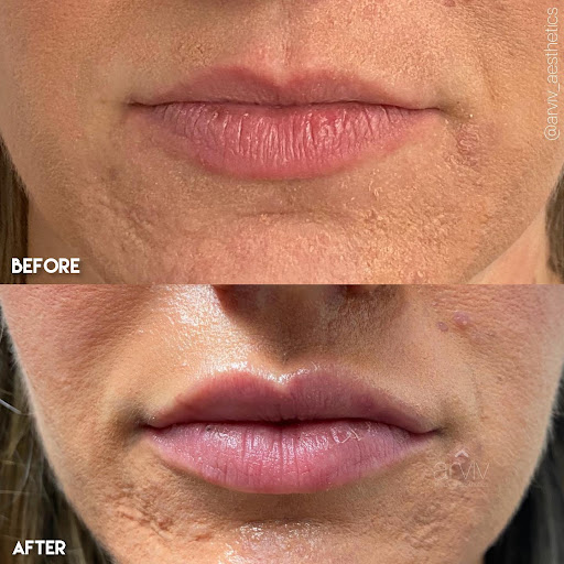 Arviv Medical Aesthetics Miami